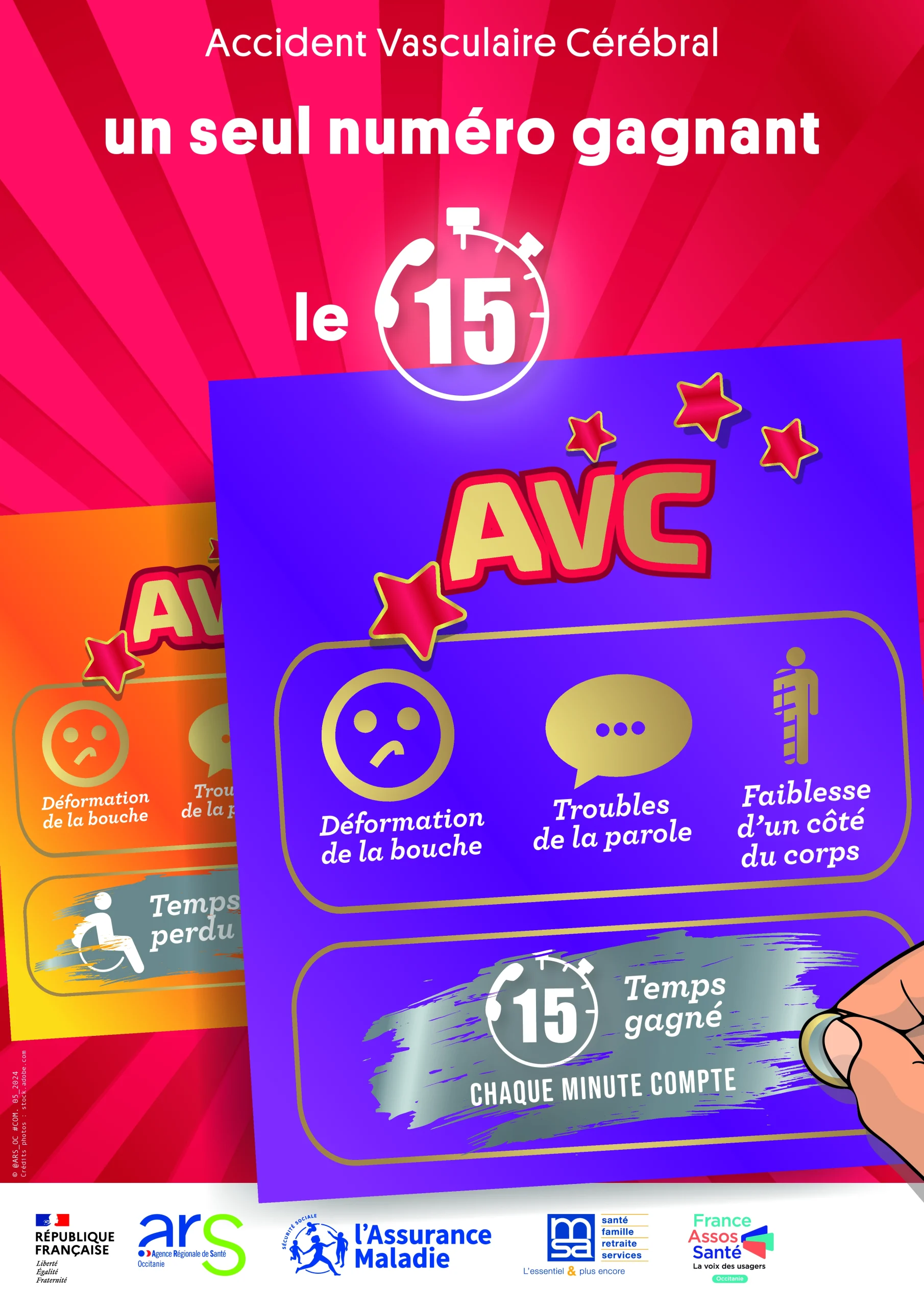 L’Accident Vasculaire Cérébral